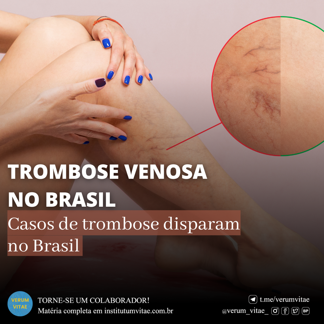 TROMBOSE VENOSA NO BRASIL