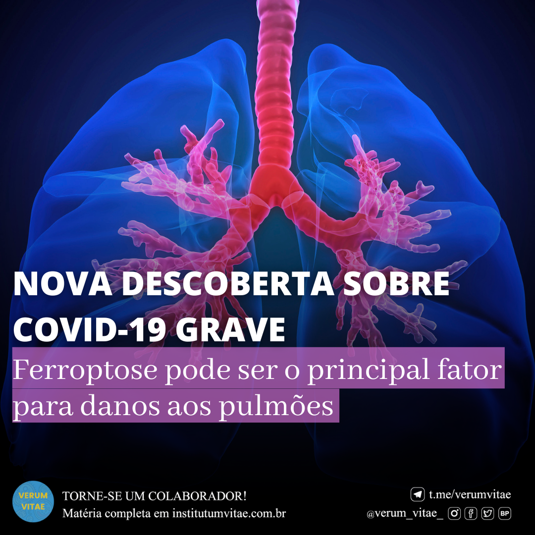 NOVA DESCOBERTA SOBRE COVID-19 GRAVE